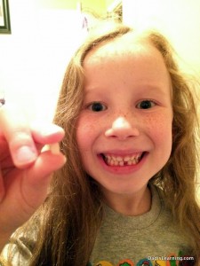 girl lost tooth